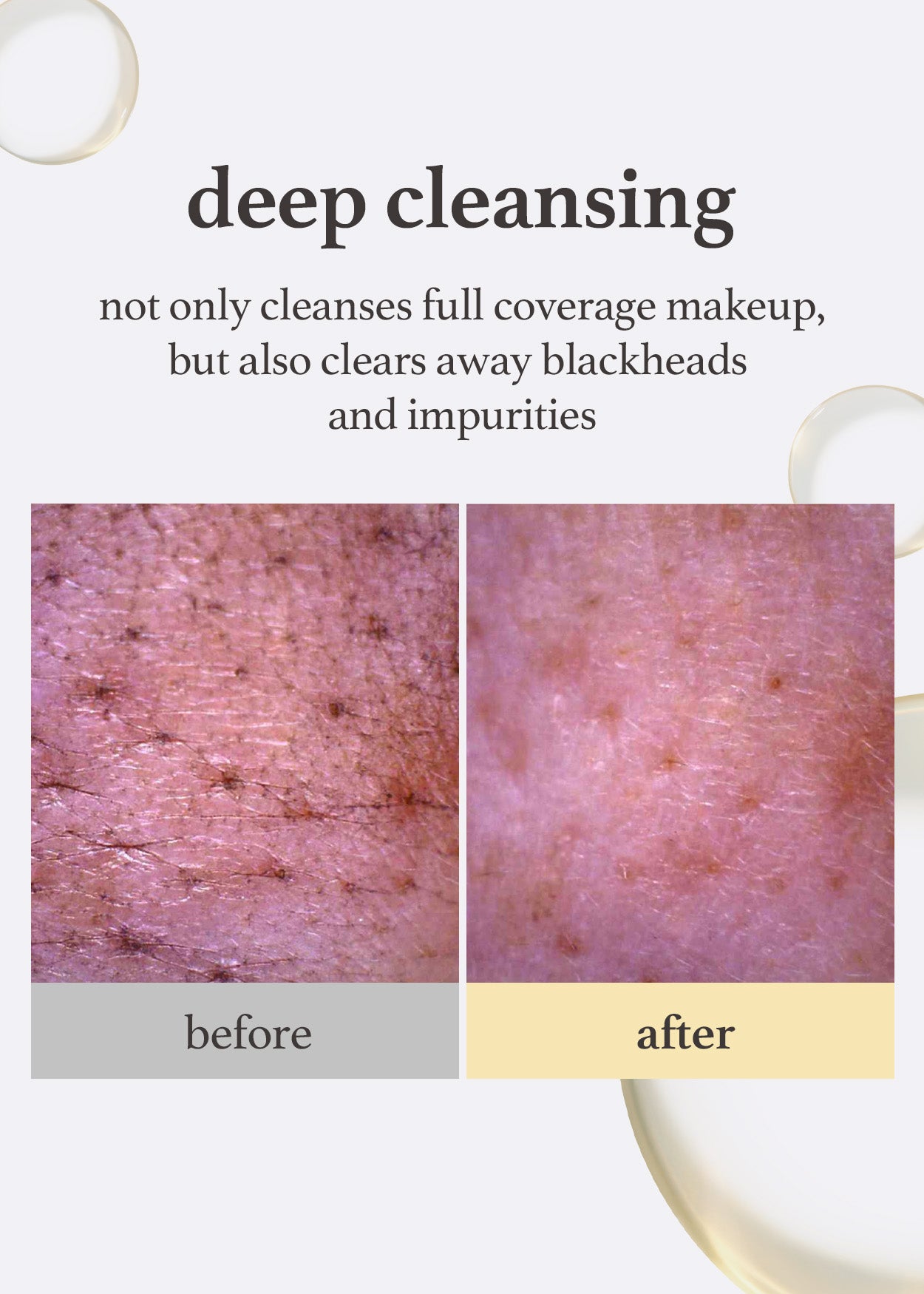 Nooni LHA Cleansing Oil deep cleansing effect: before and after comparison of blackhead and impurity removal