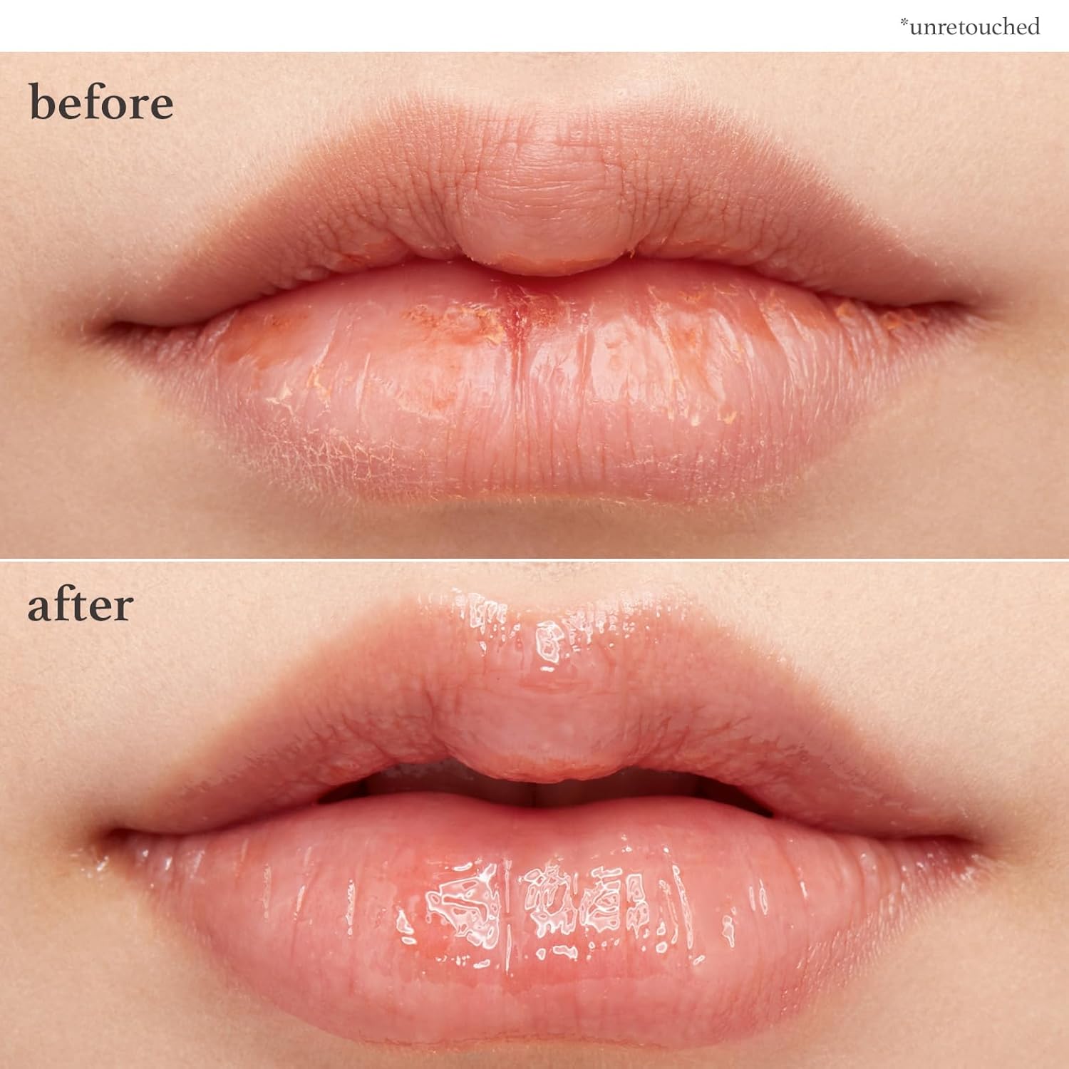 Lip Care: Applepeony Lip Oil & Lip Mask (2 - Pack) - Nooni