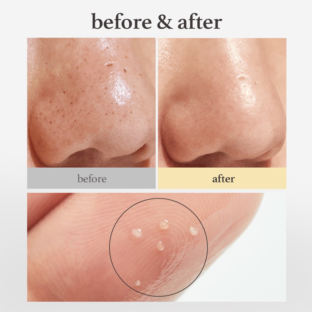 nooni Snow Aqua 0 LHA Toning Cleansing Oil - nooni
