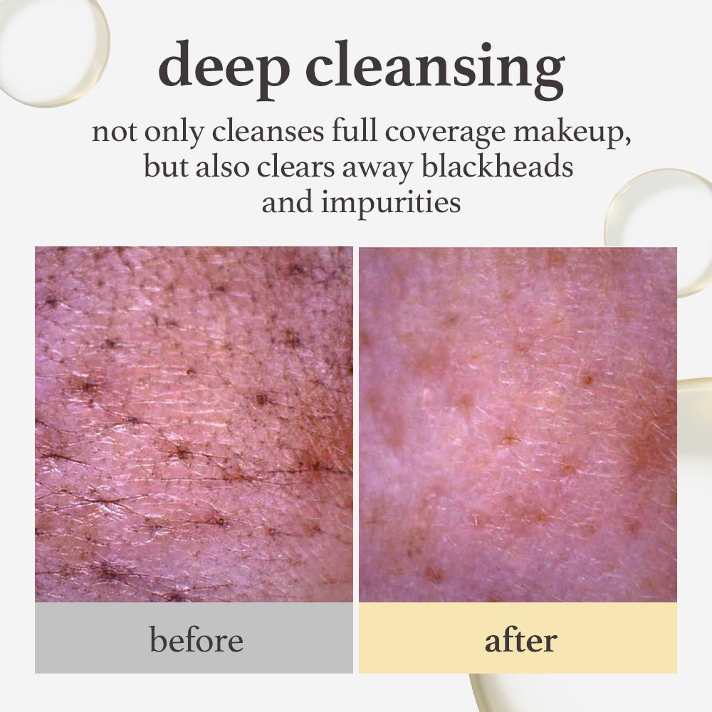 nooni Snow Aqua 0 LHA Toning Cleansing Oil - nooni